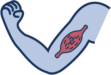 Illustration of arm muscle without dystrophin