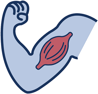 Illustration of arm muscle with dystrophin